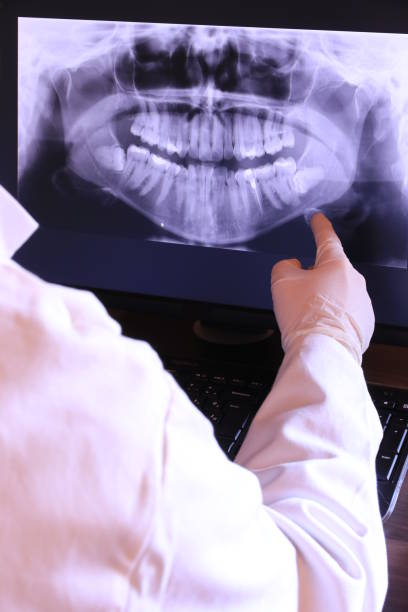 Best Root Canal Emergency Dentist  in Harper Woods, MI