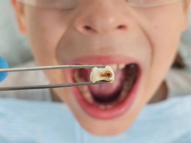Best Urgent Tooth Repair  in Harper Woods, MI